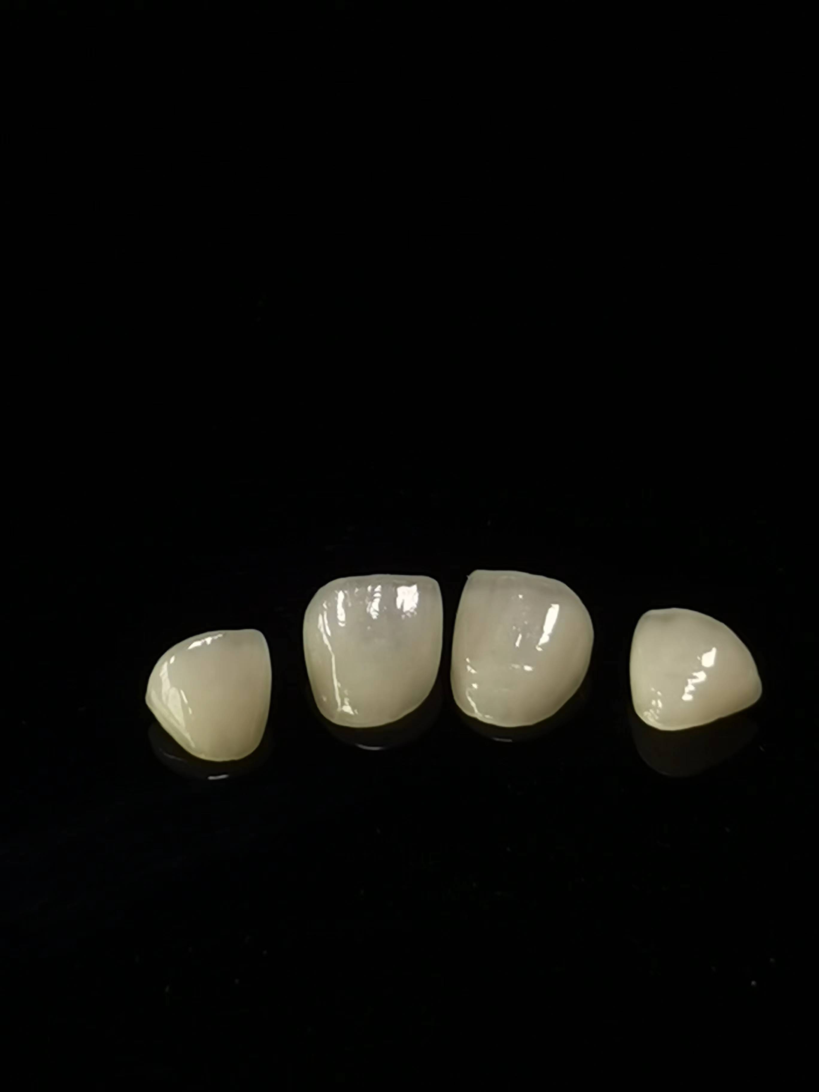 E.max Dental Lab Kerja
