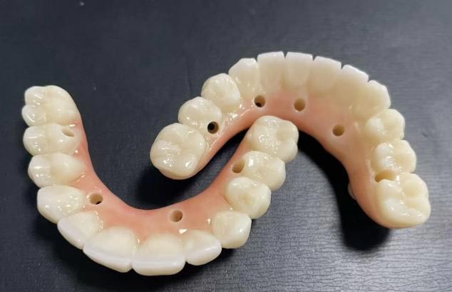 Sing luwih apik: gigi sing bisa dicopot utawa dentur tetep?