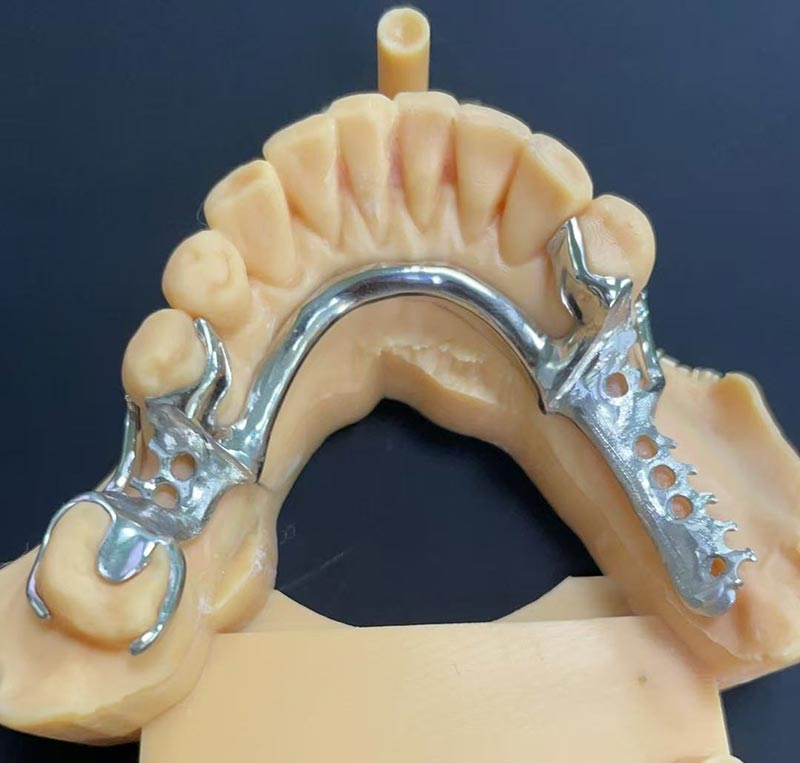 Kaluwihan saka Framework Cobalt-Chromium (Co Cr Framework)