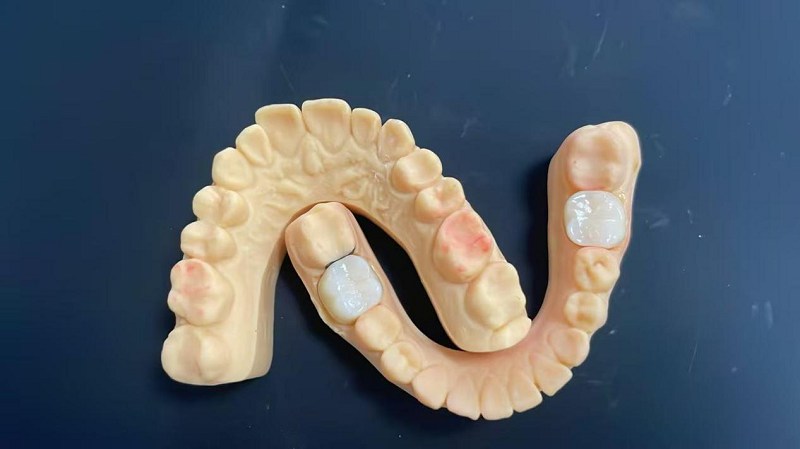 Apa pinggiran pundhak?