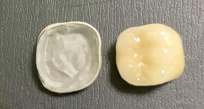 WM DENTAL LAB – Lab Gigi Cina terkemuka