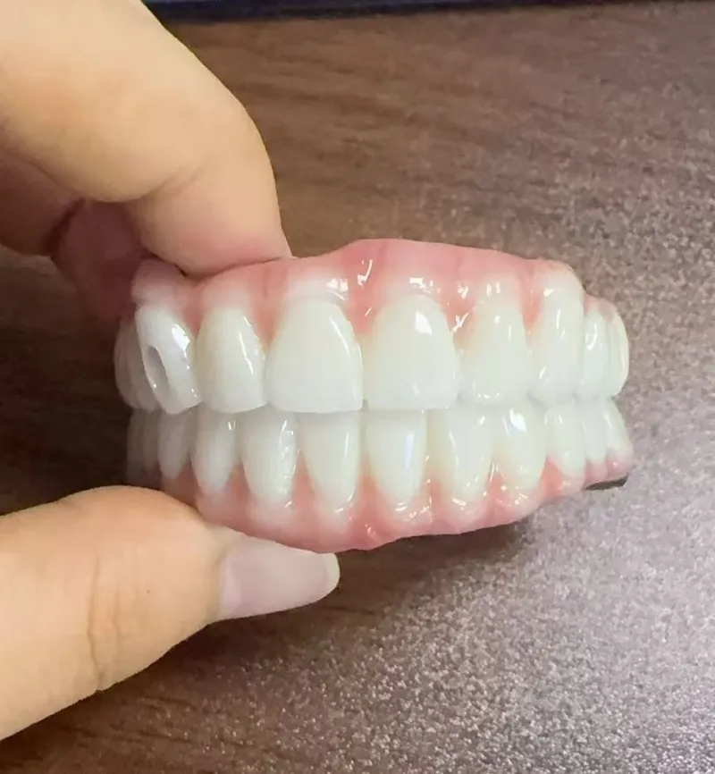 Bebaya Malocclusion