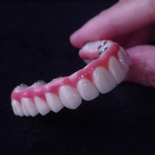 Kabeh On X Sato Bridge - Full Zirconia Bridge liwat Tibases