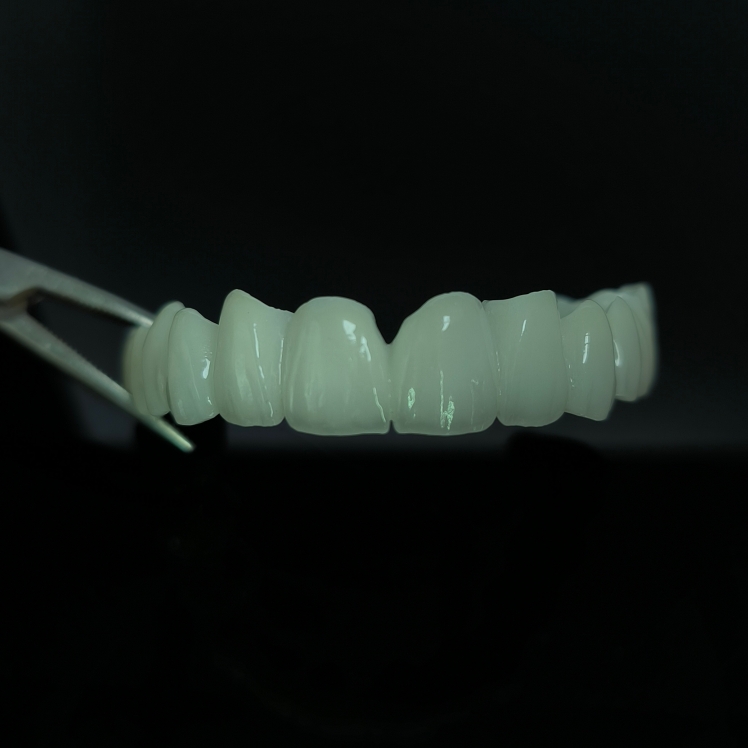 High Translucent Zirconia Bridge Layered Zirconia China Dental lab karya